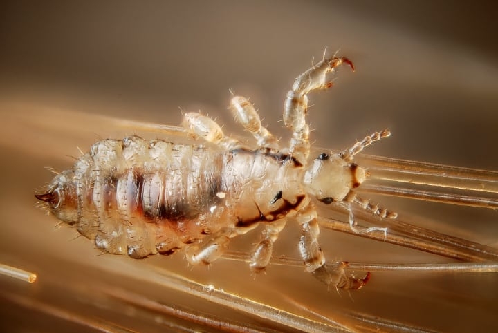 eucalyptus oil is a lice buster eucalyptus oil is a lice buster